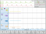 IKG CardioScreen 2000 software - trendová analýza