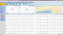software zátěžové EKG - EKG segmenty
